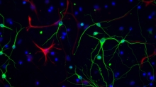 DÍA MUNDIAL DEL PARKINSON. ExoMas: la empresa argentina de base tecnológica que apuesta a desarrollar una terapia de origen biológico contra la enfermedad de Parkinson